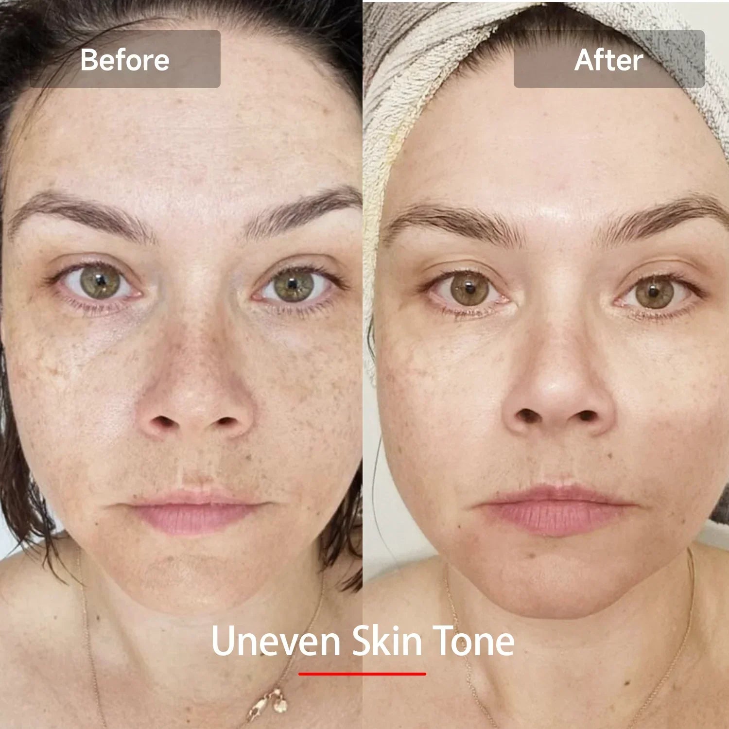 LED Rejuvenation Mask - LuminaGlow