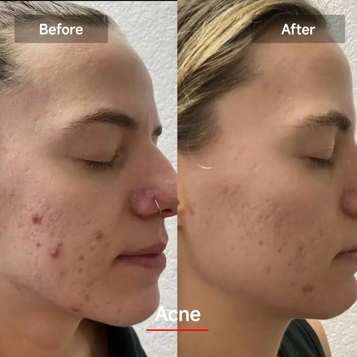 LED Rejuvenation Mask - LuminaGlow