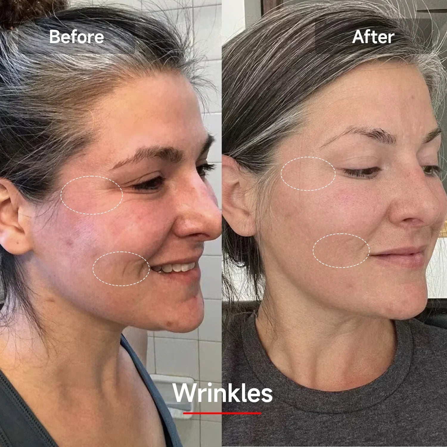 LED Rejuvenation Mask - LuminaGlow