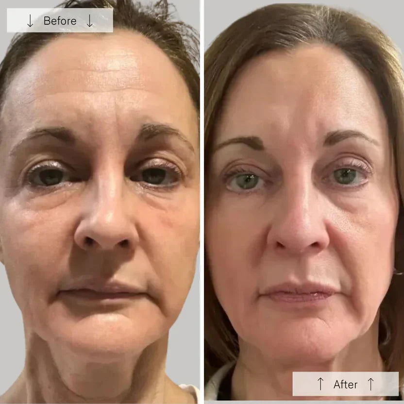 Revitalizing LED Phototherapy Mask - LuminaGlow