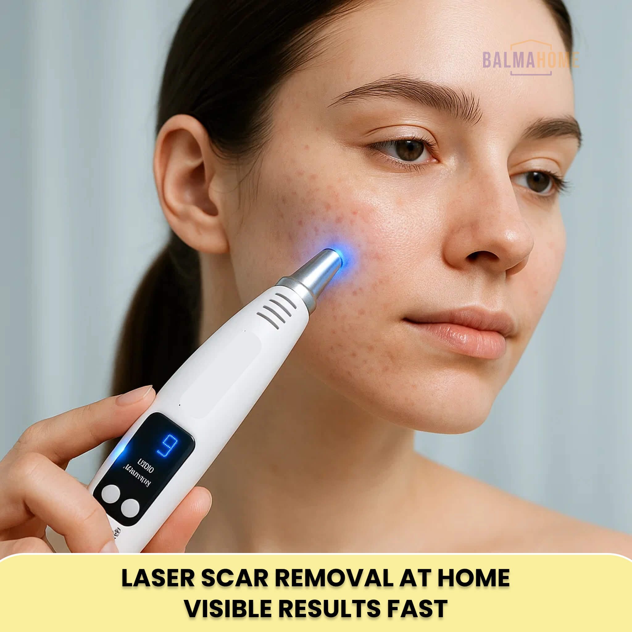 Blue Light Therapy Laser Pen - LuminaSkin