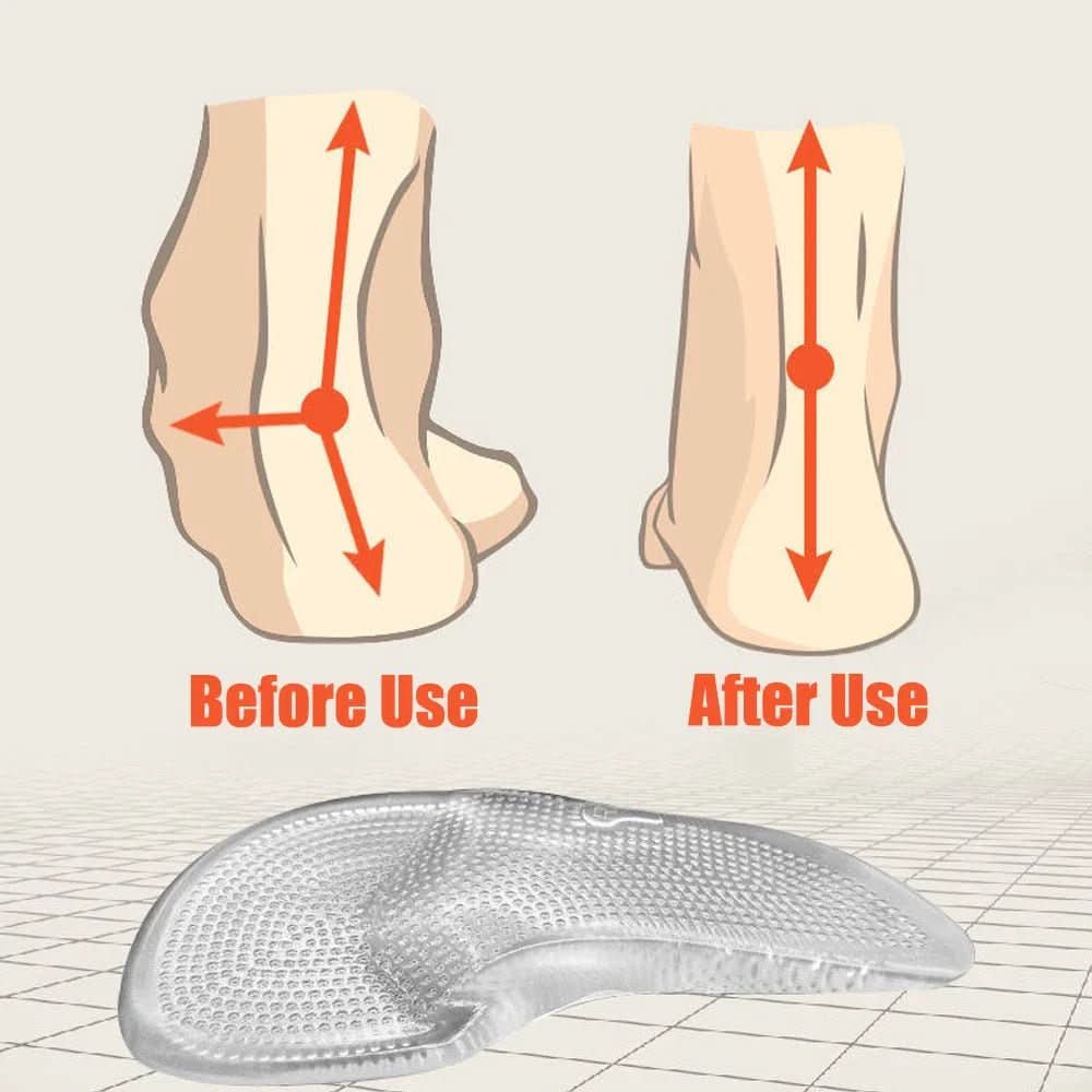 Arch Support Gel Insoles - SoleLux Comfort Solutions