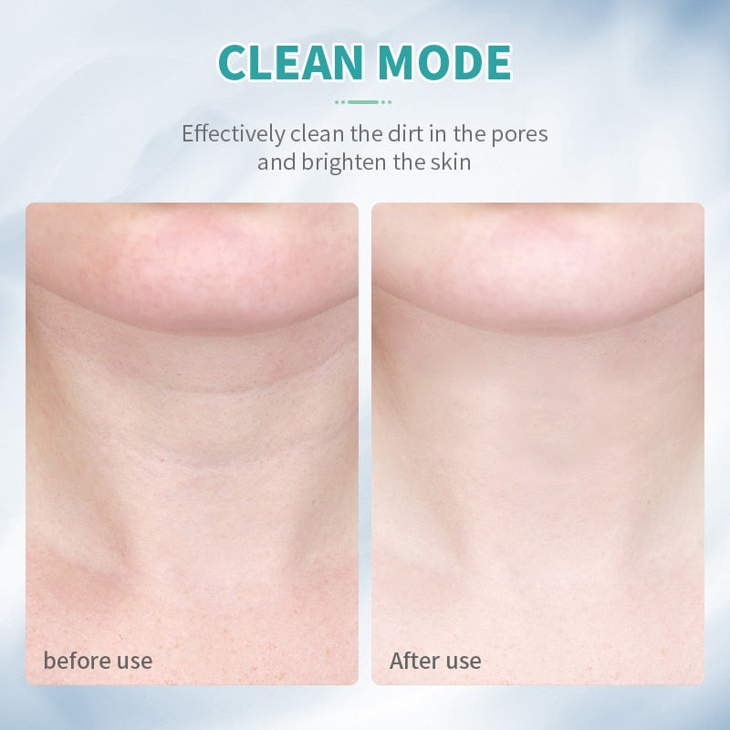 Radiant Skin Device - LuxeGlow