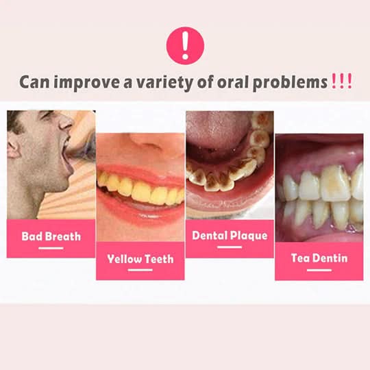 Ultrasonic Tooth Cleaner - PureSmile Essentials