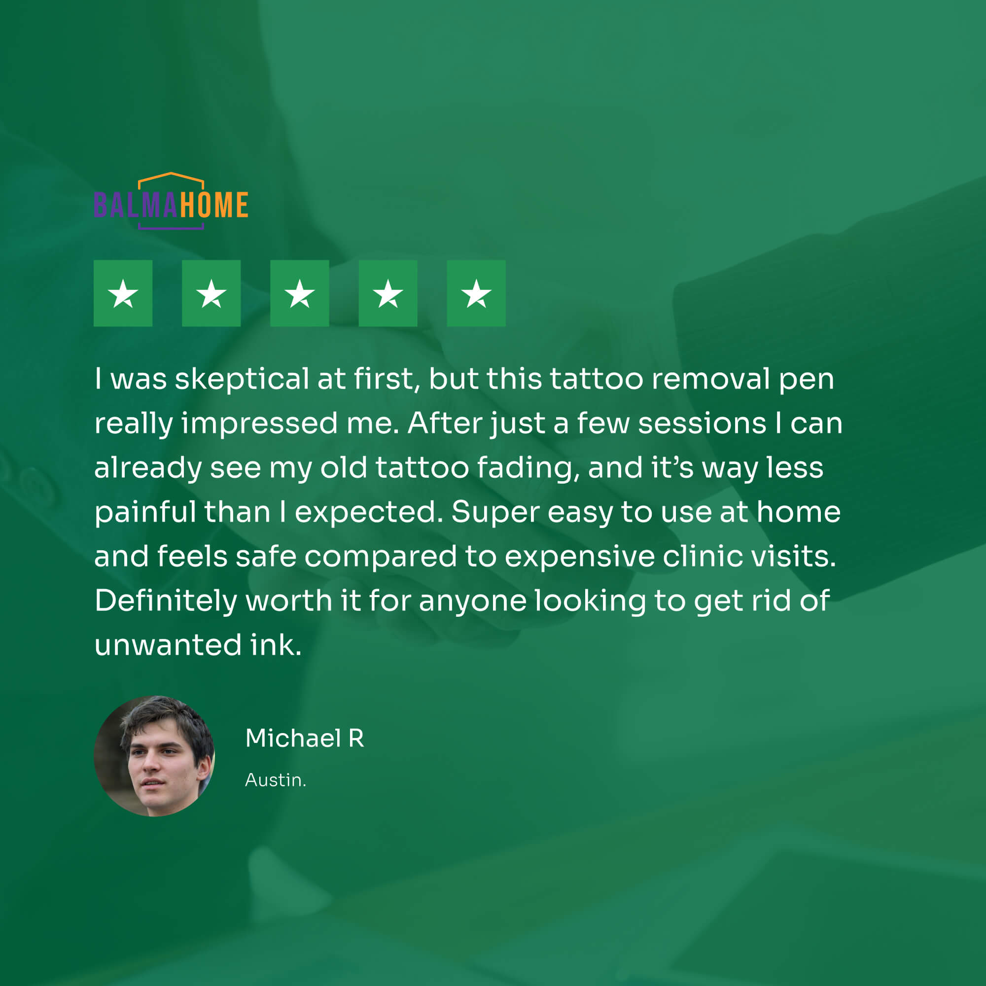 Tattoo Removal Laser Pen - InkFade Pro
