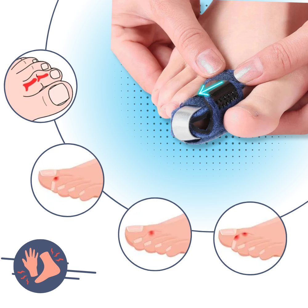 Toe Straightener - AlignWell