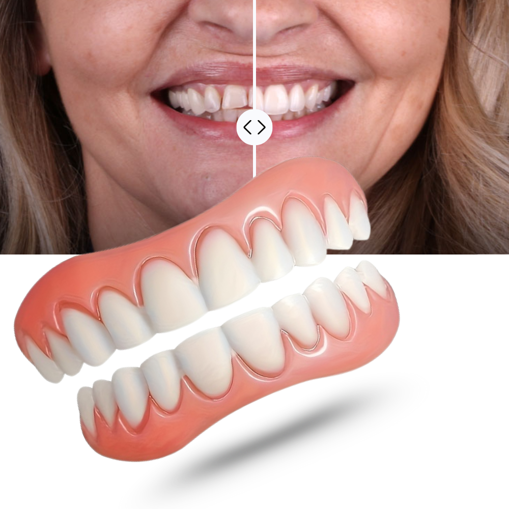 Denture Solution - SmileCraft with Strong Adhesive Fit