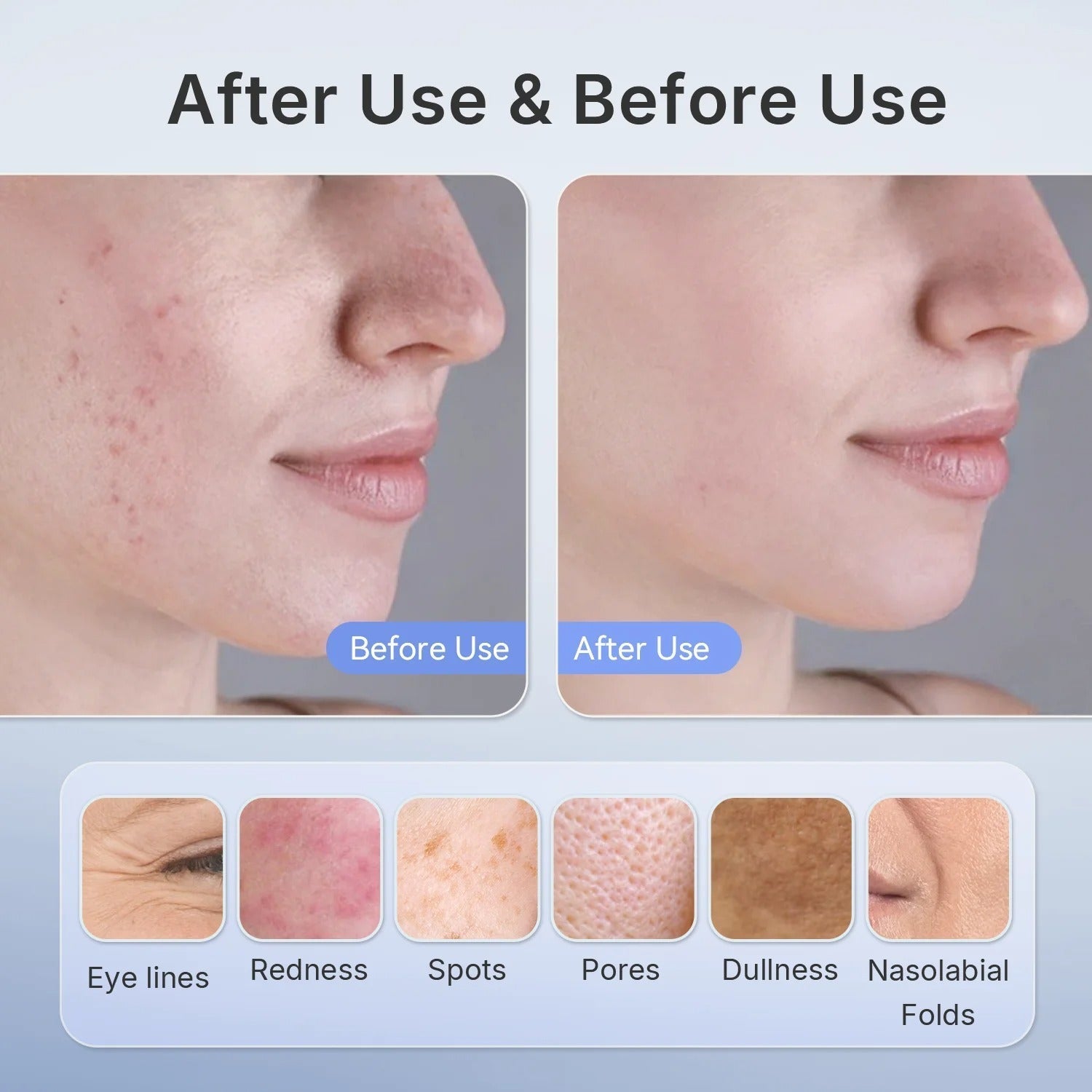 Revitalizing LED Phototherapy Mask - LuminaGlow