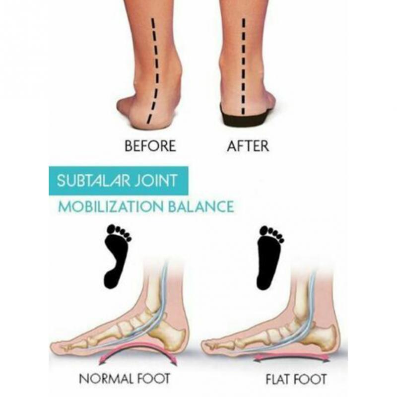 Bunion Corrector 2.0 - SoleHarmony