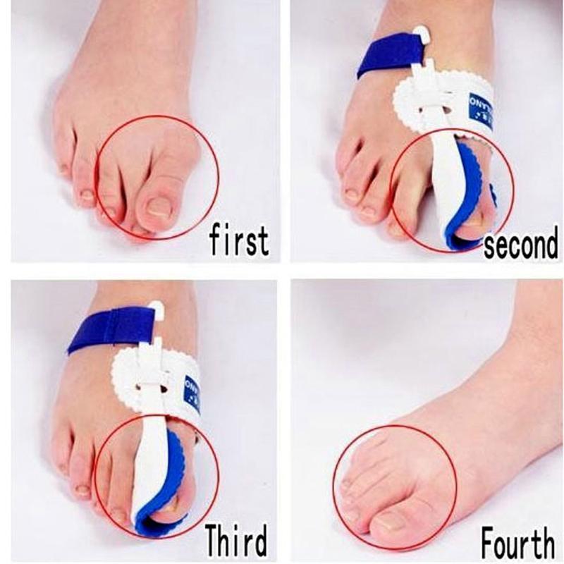 Bunion Adjuster Orthotics - SoleEase Comfort Solutions