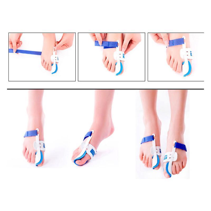 Bunion Adjuster Orthotics - SoleEase Comfort Solutions