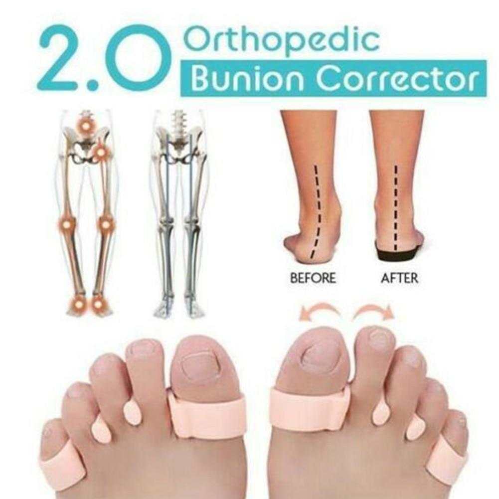 Bunion Corrector 2.0 - SoleHarmony