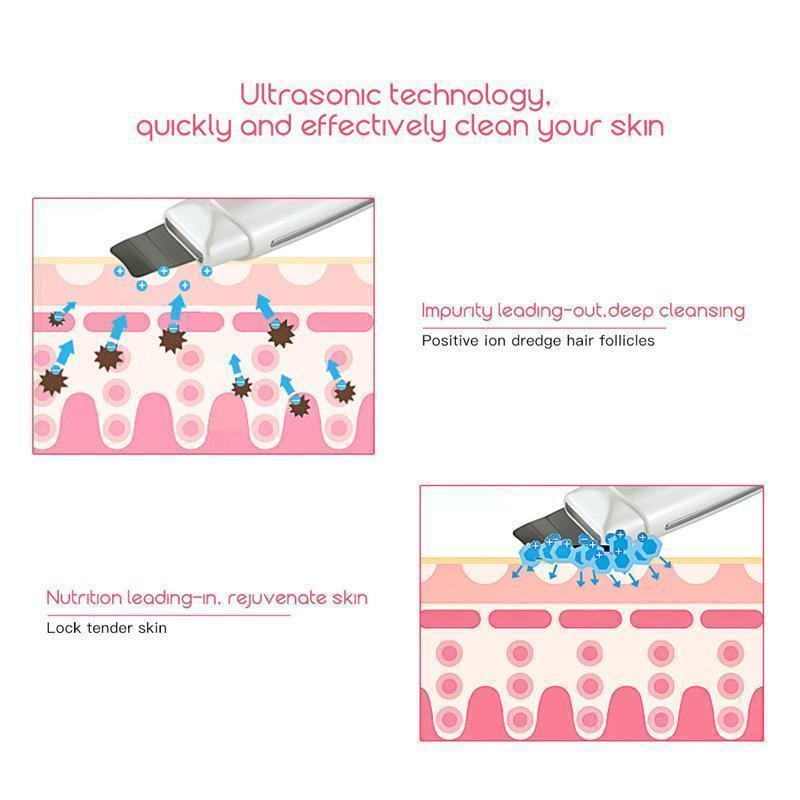 Ultrasonic Skin Revitalizer - LuxeGlow