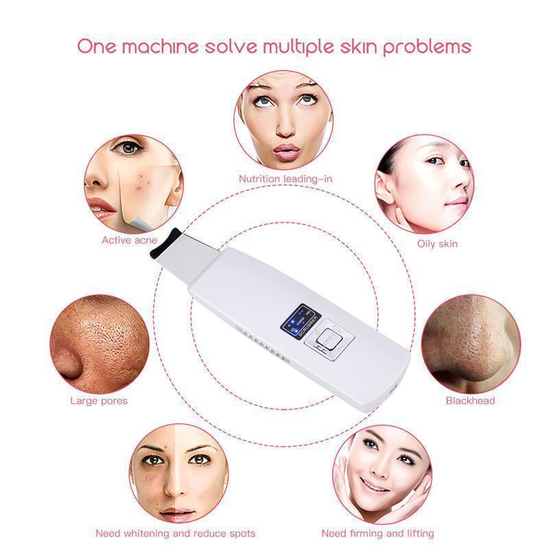 Ultrasonic Skin Revitalizer - LuxeGlow